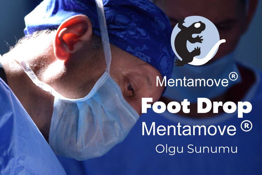 Drop Foot Mentamove