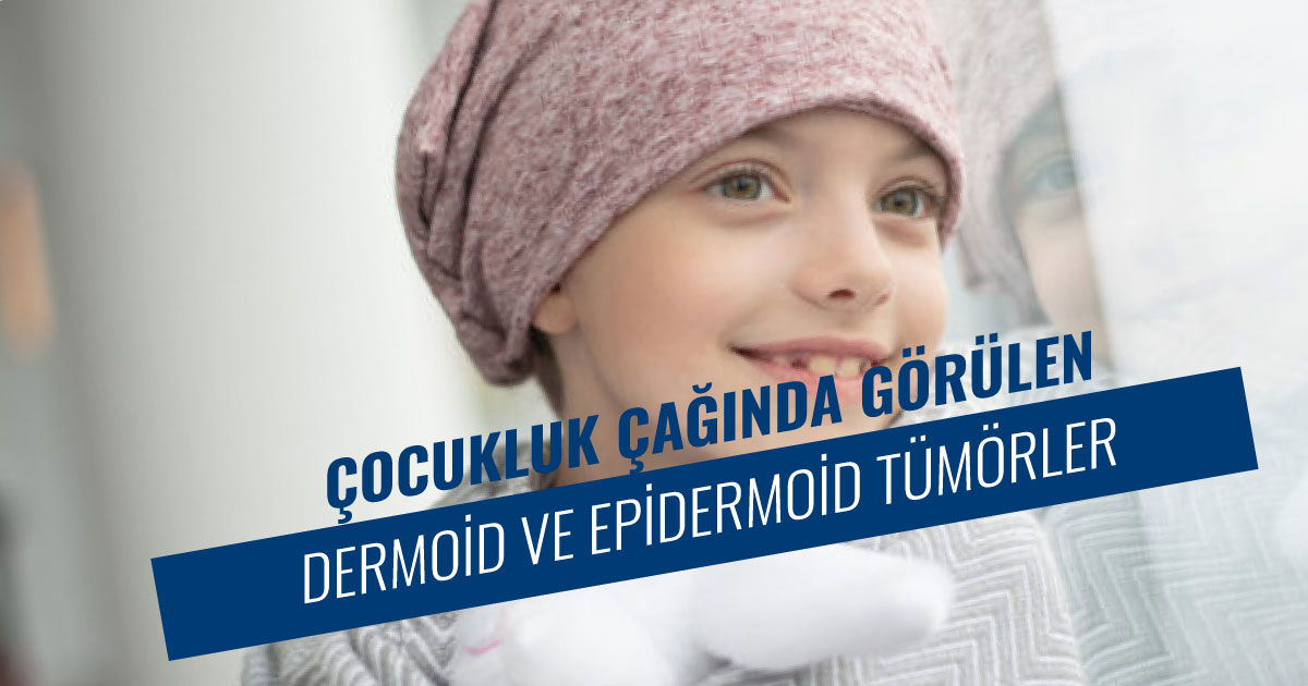 Dermoid ve epidermoid tümörler
