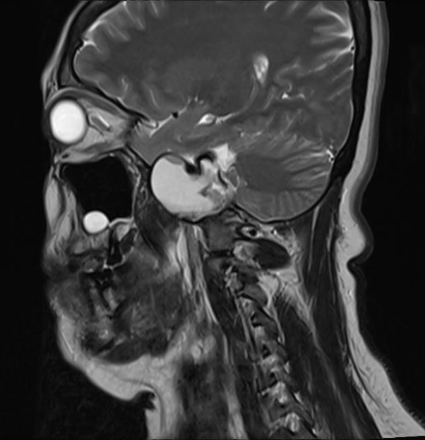 Brain MRI Axial an Sagital Slices