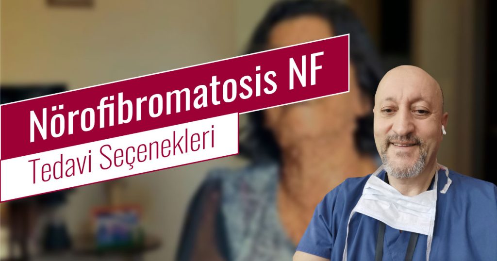 Nörofibromatosis Tedavi Seçenekleri