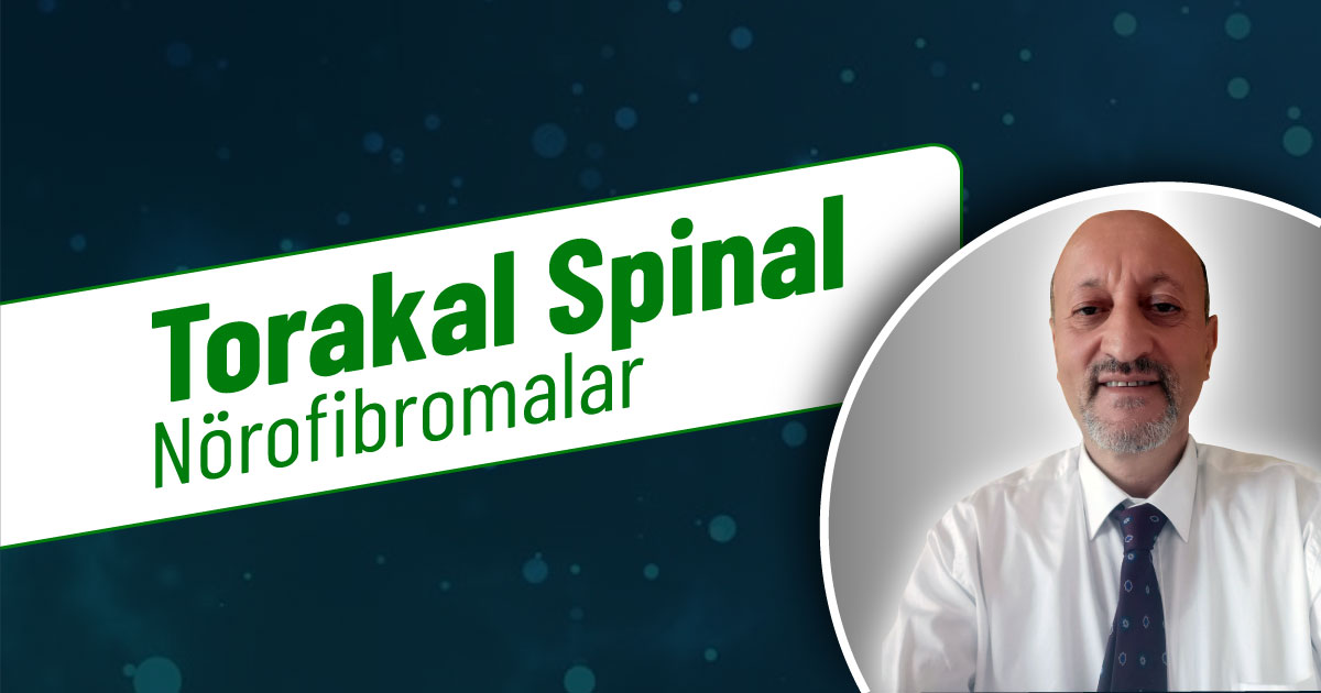 Torakal spinal nörofibromalar
