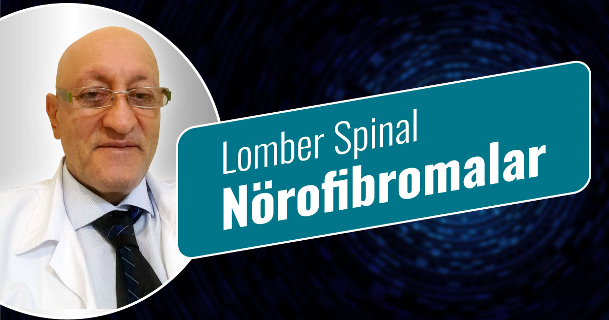Lomber Spinal Nörofibromalar