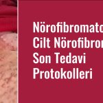Nörofibromatozis, Cilt Nörofibromları, Son Tedavi Protokolleri